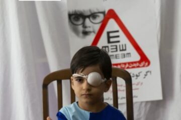 غربالگری بینایی ۱۰۴ هزار کودک لرستانی